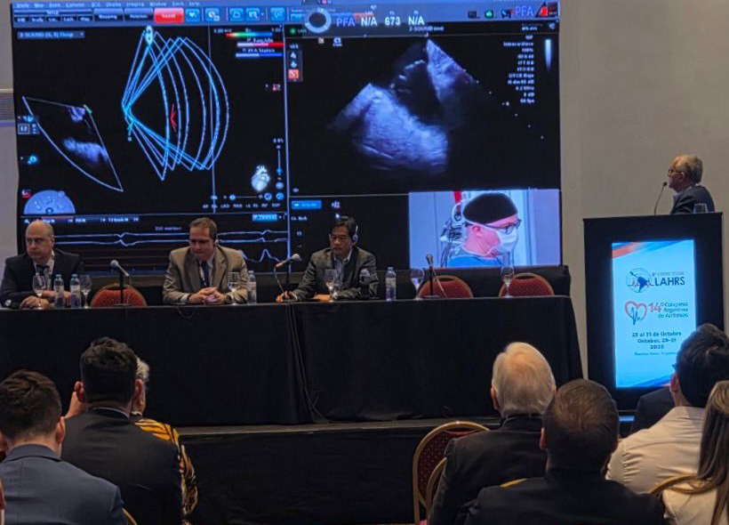 Argentina: Johnson & Johnson MedTech introdujo nueva tecnología para tratar la fibrilación auricular